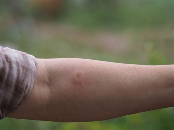 Can wasp sting through clothes?