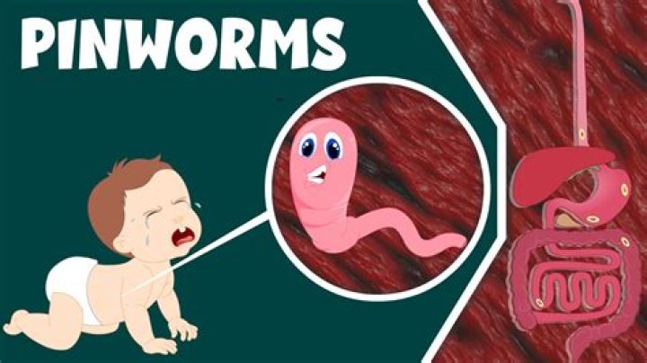 How do you shower with pinworms?