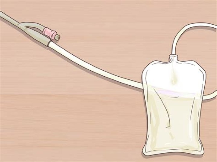 How often should a catheter bag be changed?