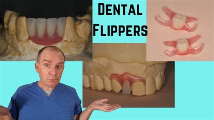 What is a dental Flipper?