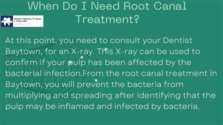 When do I need root canal?