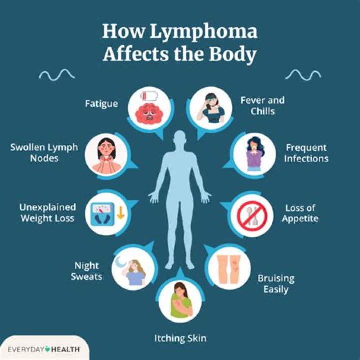 Who is most at risk for lymphoma?